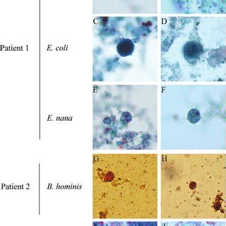 alcorfix|Clinical and Analytical Evaluation of a Single